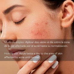 Serum facial antiacne directo - 30 ml-VAL-10561-valquer